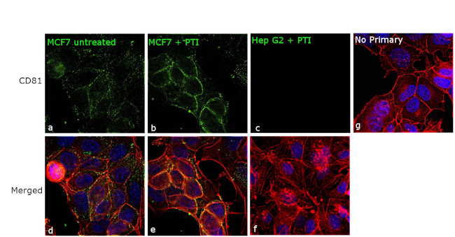 CD81 Antibody in Immunocytochemistry (ICC/IF)