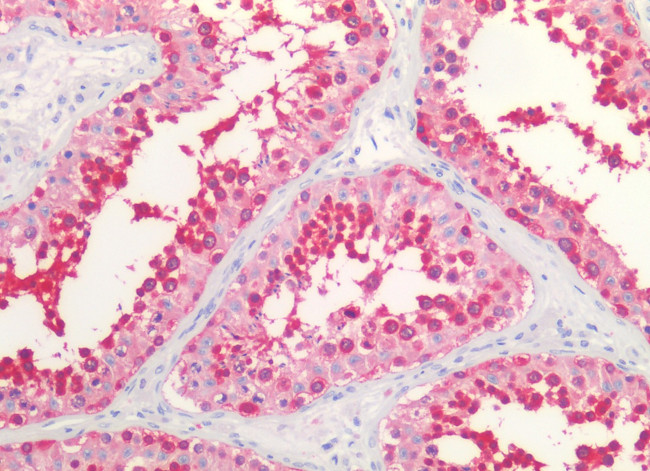 HSP90 Antibody in Immunohistochemistry (Paraffin) (IHC (P))