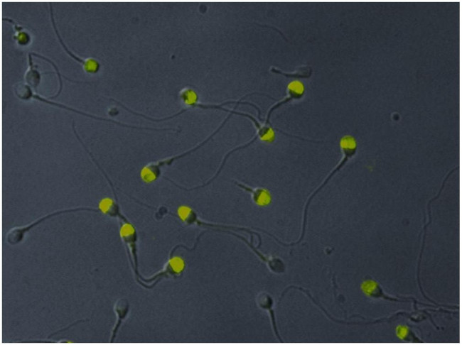 VCP Antibody in Immunocytochemistry (ICC/IF)