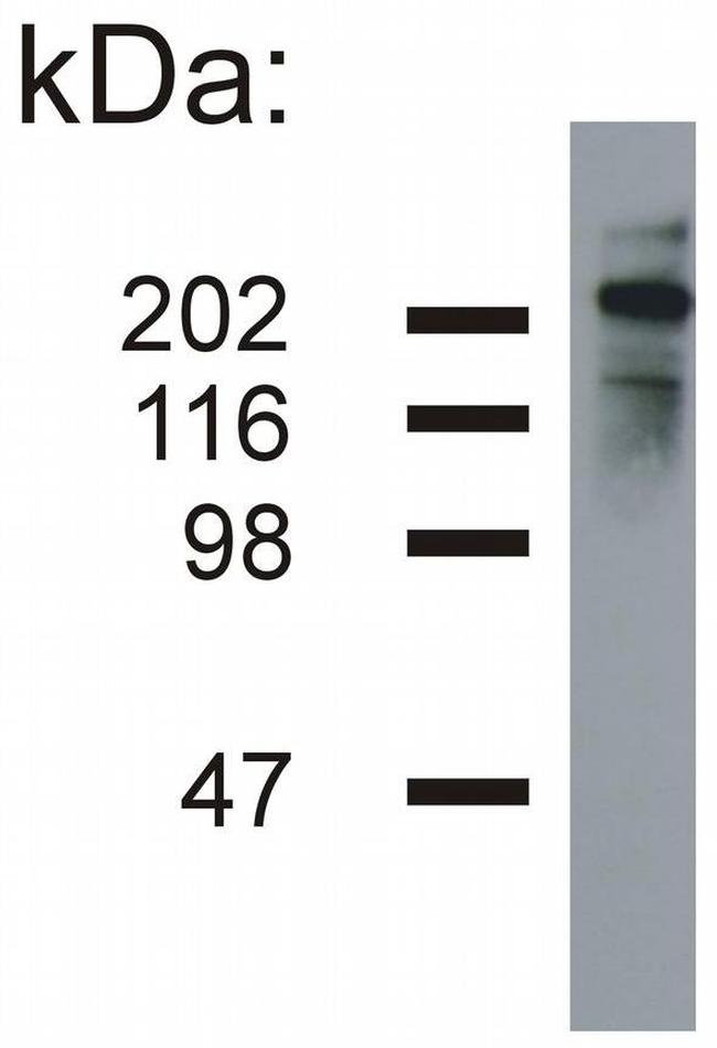 NF-H Antibody in Western Blot (WB)