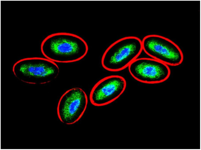 Vimentin Antibody in Immunocytochemistry (ICC/IF)