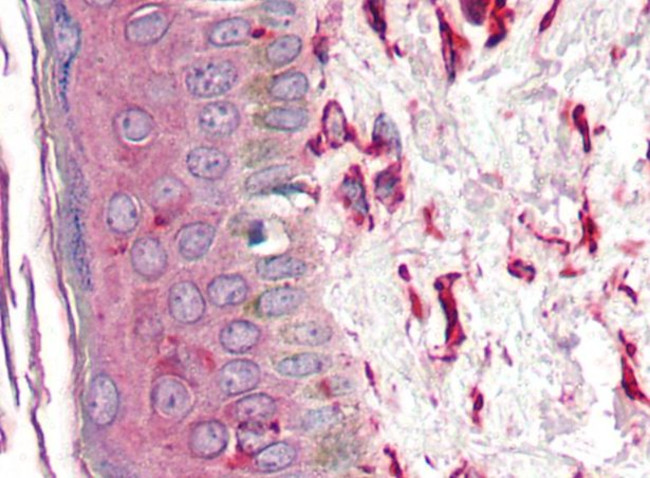 Vimentin Antibody in Immunohistochemistry (Paraffin) (IHC (P))