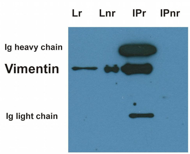 Vimentin Antibody in Immunoprecipitation (IP)