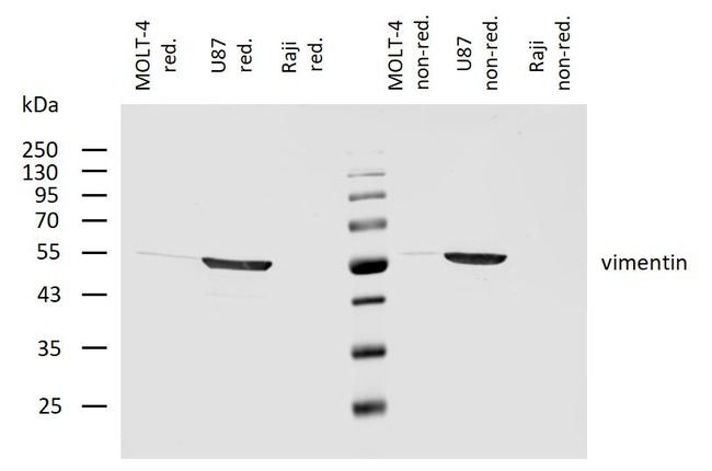 Vimentin Antibody in Western Blot (WB)