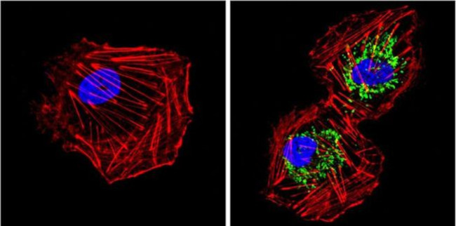 SOD2 Antibody in Immunocytochemistry (ICC/IF)