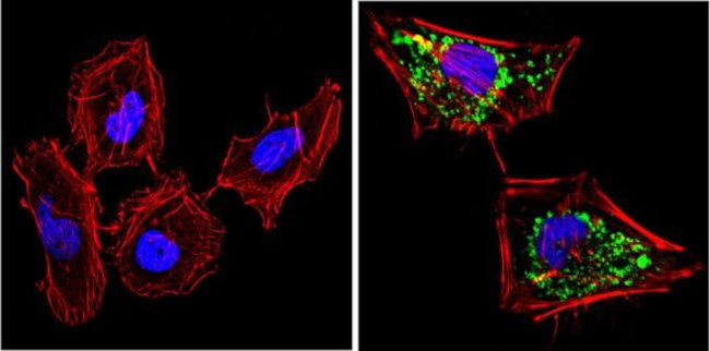 SOD2 Antibody in Immunocytochemistry (ICC/IF)