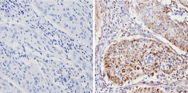 SOD2 Antibody in Immunohistochemistry (Paraffin) (IHC (P))