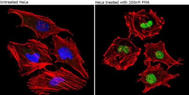 Phospho-CREB/ATF1 (Ser133, Ser63) Antibody in Immunocytochemistry (ICC/IF)