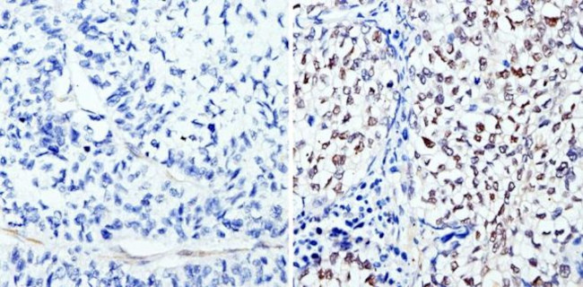 Phospho-CREB/ATF1 (Ser133, Ser63) Antibody in Immunohistochemistry (Paraffin) (IHC (P))