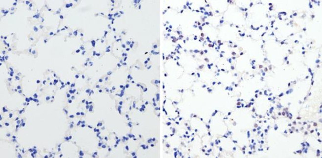 Phospho-CREB/ATF1 (Ser133, Ser63) Antibody in Immunohistochemistry (Paraffin) (IHC (P))