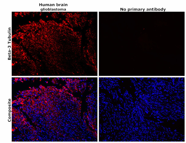 beta-3 Tubulin Antibody in Immunohistochemistry (Paraffin) (IHC (P))