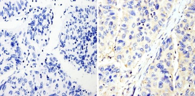 RhoA/RhoC Antibody in Immunohistochemistry (Paraffin) (IHC (P))