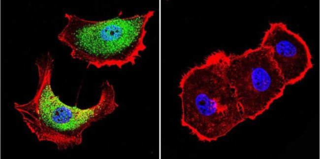 ZPR1 Antibody in Immunocytochemistry (ICC/IF)