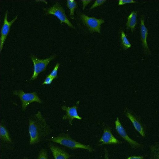 rRNA Antibody in Immunocytochemistry (ICC/IF)