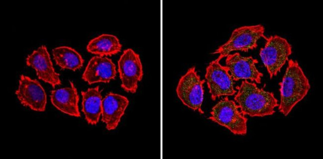 BID Antibody in Immunocytochemistry (ICC/IF)