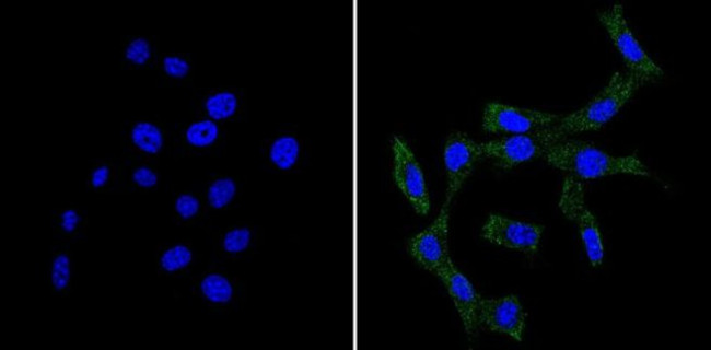 BID Antibody in Immunocytochemistry (ICC/IF)