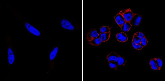 SSEA5 Antibody in Immunocytochemistry (ICC/IF)