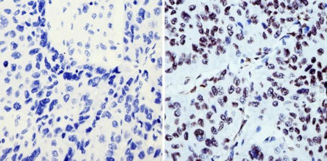 BCR-ABL Antibody in Immunohistochemistry (Paraffin) (IHC (P))