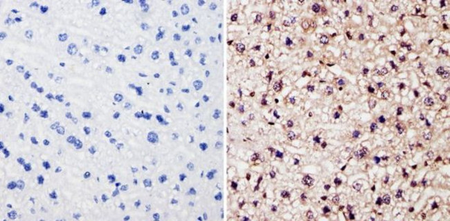 BCR-ABL Antibody in Immunohistochemistry (Paraffin) (IHC (P))