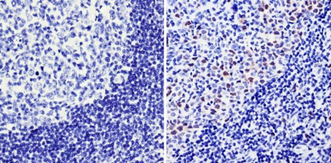 Cyclin A2 Antibody in Immunohistochemistry (Paraffin) (IHC (P))