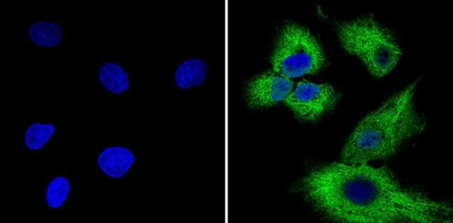 Cyclin B1 Antibody in Immunocytochemistry (ICC/IF)