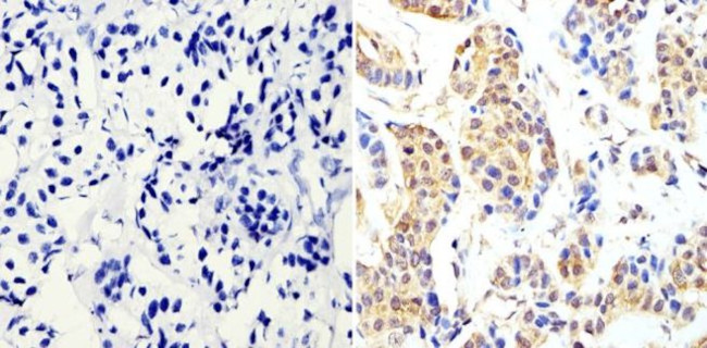 Cyclin B1 Antibody in Immunohistochemistry (Paraffin) (IHC (P))