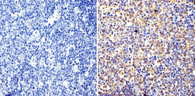 Cyclin B1 Antibody in Immunohistochemistry (Paraffin) (IHC (P))