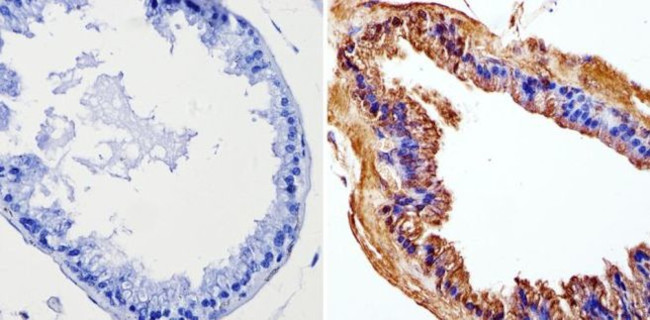 Cyclin B1 Antibody in Immunohistochemistry (Paraffin) (IHC (P))