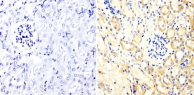 PKC alpha Antibody in Immunohistochemistry (Paraffin) (IHC (P))