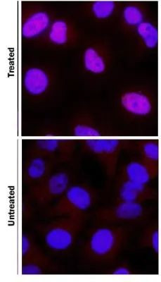 HIF1A Antibody in Immunocytochemistry (ICC/IF)