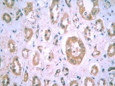 HIF1A Antibody in Immunohistochemistry (Paraffin) (IHC (P))