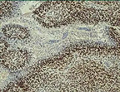 HIF-1 beta Antibody in Immunohistochemistry (Paraffin) (IHC (P))