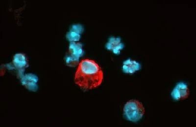 HIF1A Antibody in Immunocytochemistry (ICC/IF)