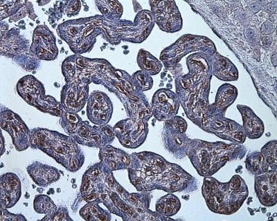 HIF1A Antibody in Immunohistochemistry (Paraffin) (IHC (P))