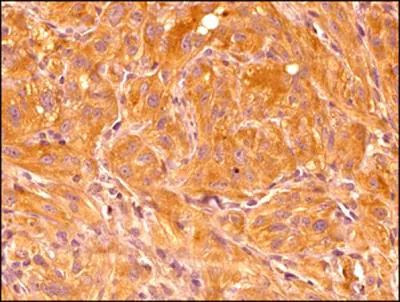 HIF1A Antibody in Immunohistochemistry (Paraffin) (IHC (P))