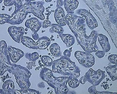 HIF1A Antibody in Immunohistochemistry (Paraffin) (IHC (P))