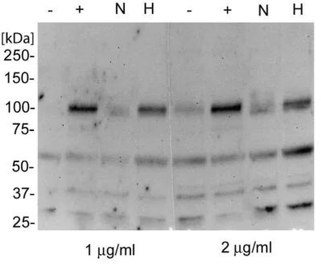 HIF-2 alpha Antibody in Western Blot (WB)