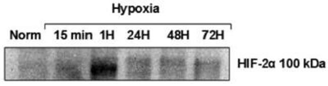 HIF-2 alpha Antibody in Western Blot (WB)