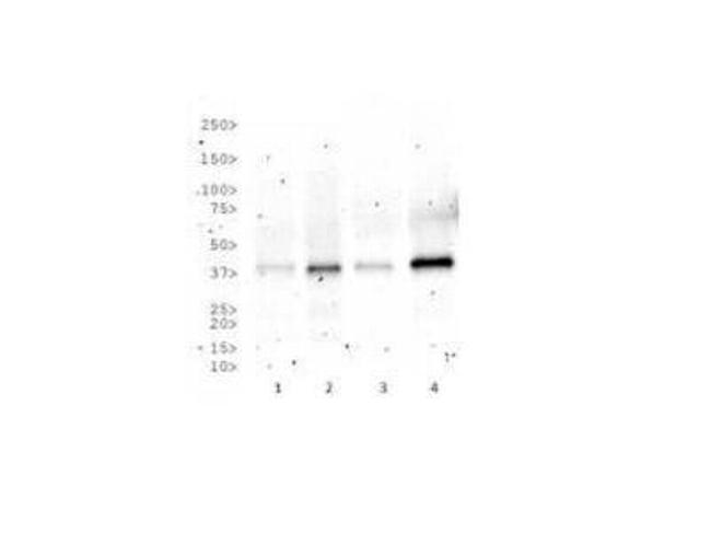 RAD51C Antibody in Western Blot (WB)