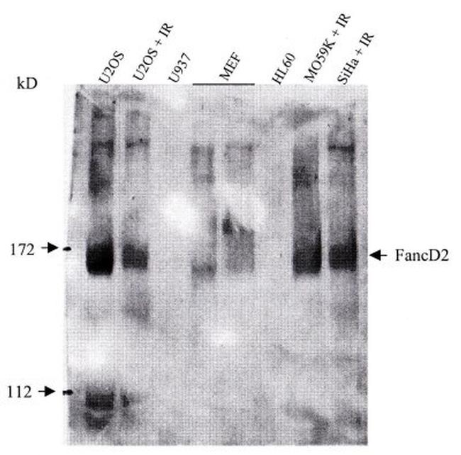 FANCD2 Antibody in Western Blot (WB)