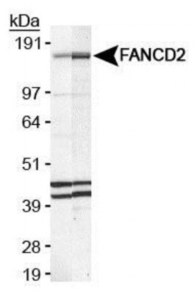 FANCD2 Antibody in Western Blot (WB)