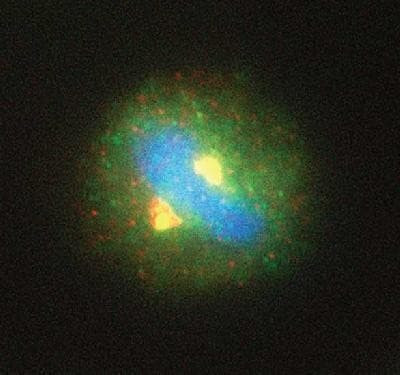 Separase Antibody in Immunocytochemistry (ICC/IF)