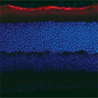 RPE65 Antibody in Immunohistochemistry (Frozen) (IHC (F))