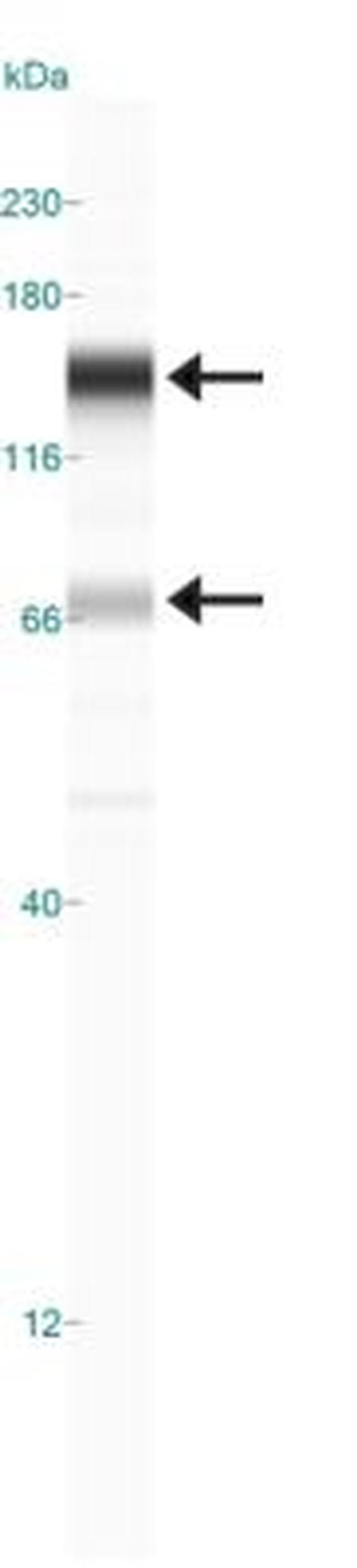 RAD21 Antibody in Western Blot (WB)