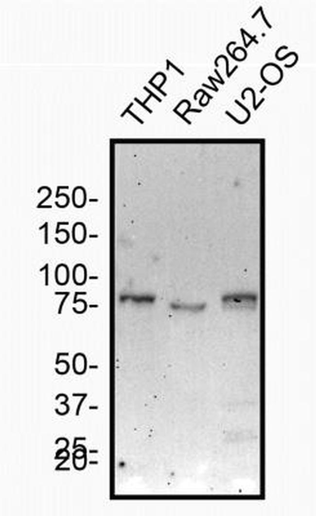 NOD2 Antibody in Western Blot (WB)