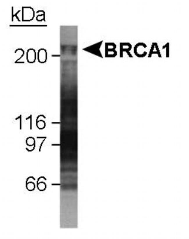 BRCA1 Antibody in Western Blot (WB)