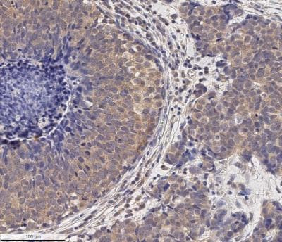 MMP2 Antibody in Immunohistochemistry (Paraffin) (IHC (P))