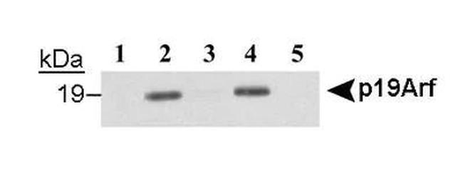 p19ARF Antibody in Western Blot (WB)