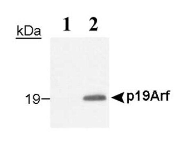 p19ARF Antibody in Western Blot (WB)