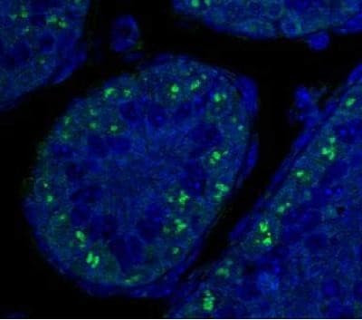 p19ARF Antibody in Immunohistochemistry (IHC)